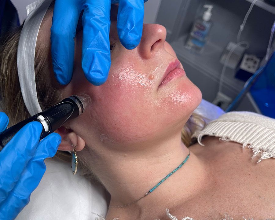 beeme-med-spa_houston-medical-spa_hydrafacials-01